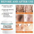 Skin Brightening Cream for Private Parts