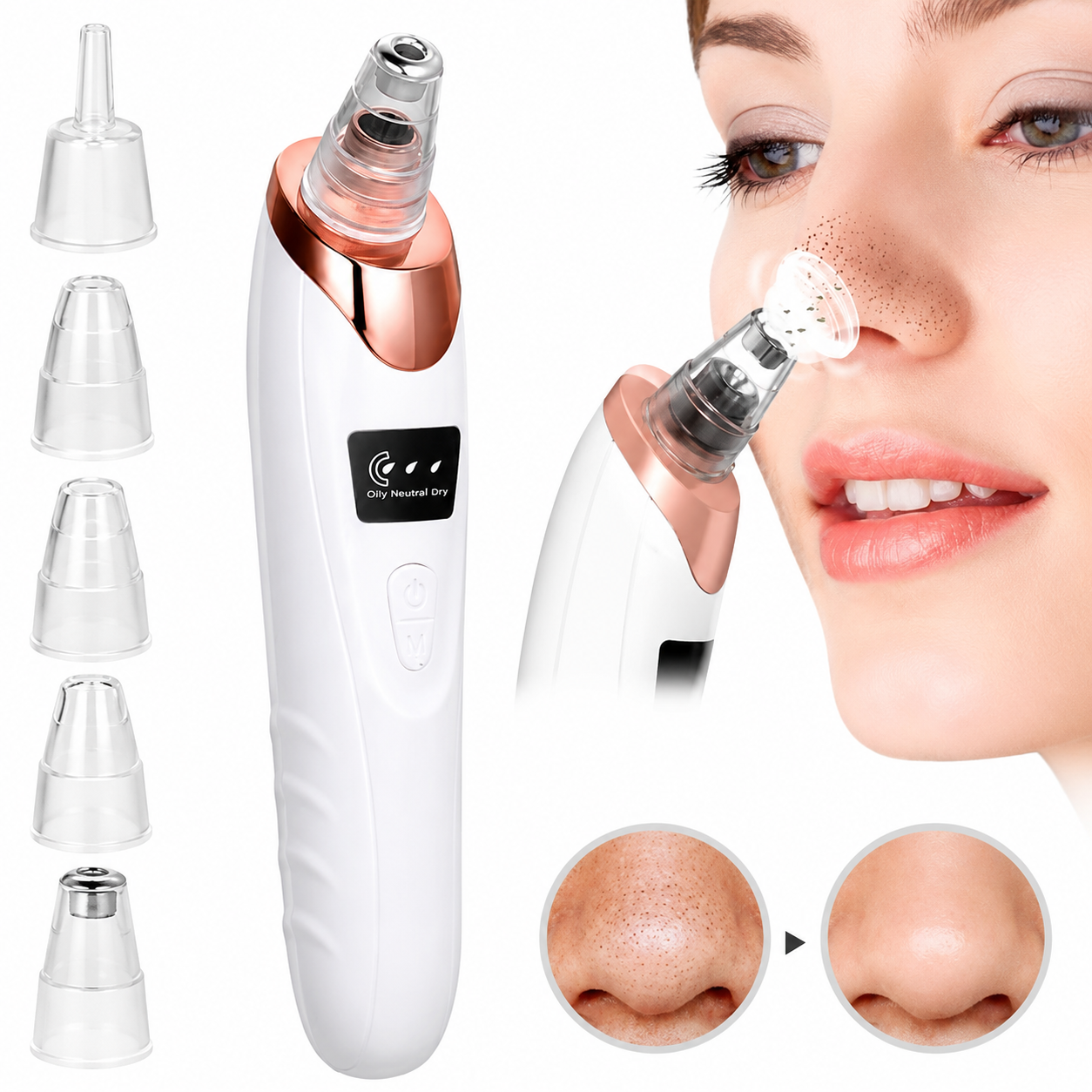 5in1 Blackhead Remover Machine
